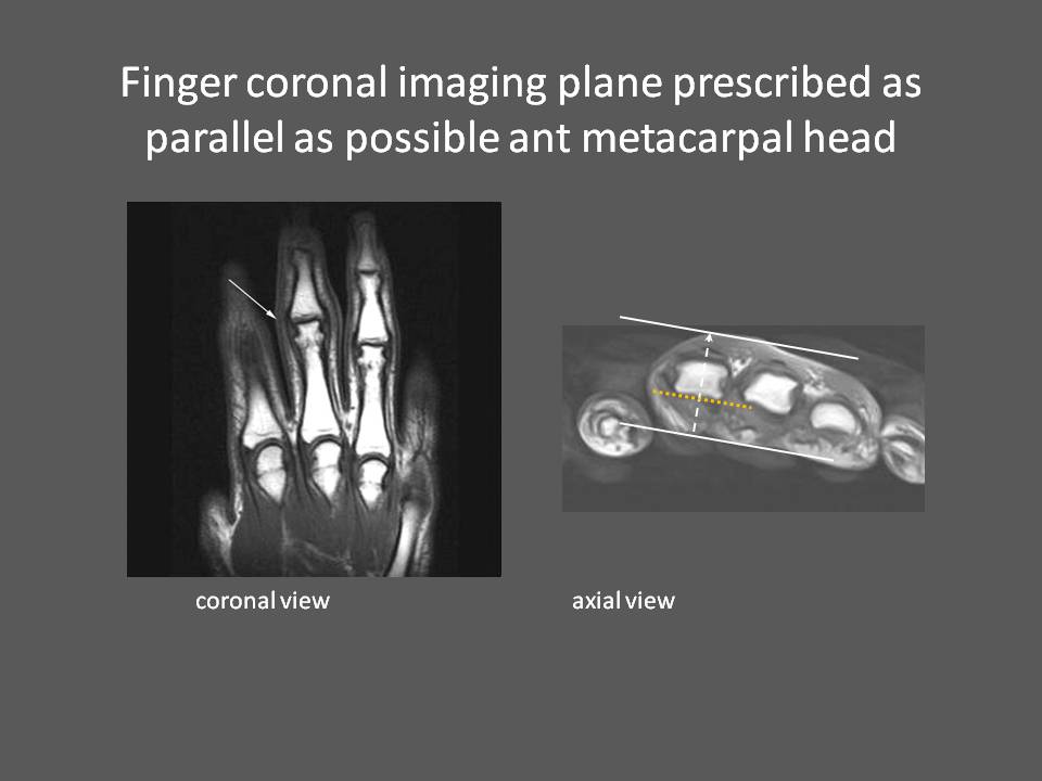 MRI Wrist How we do it How is MRI Wrist done at Mater Dei Hospital